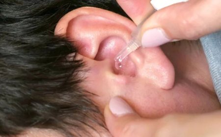 Kenali Penyebab Sakit Telinga dan Cara Mengatasinya dengan Mudah