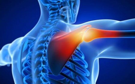 Ancaman Senyap di Lapangan: Kupas Tuntas Dislokasi Bahu yang Bisa Mengakhiri Karir Atlet