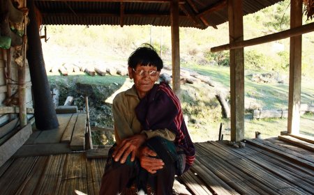 Batuk Tak Kunjung Sembuh Lebih dari 2 Minggu? Awas, Ini Gejala Batuk TBC yang Sering Diabaikan!