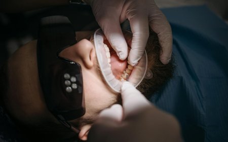 Hubungan Mengejutkan Antara Kesehatan Gusi dan Risiko Penyakit Jantung