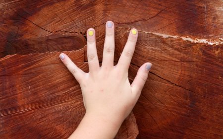 Warna Kuku Bisa Mengungkap Masalah Kesehatan Anda