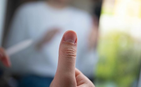 Kebiasaan Sehari-hari yang Diam-diam Merusak Kuku Anda