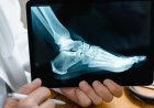 Fakta Tersembunyi Mikrobioma Mulut Gerbang Kesehatan Jantung, Diabetes, Otak!