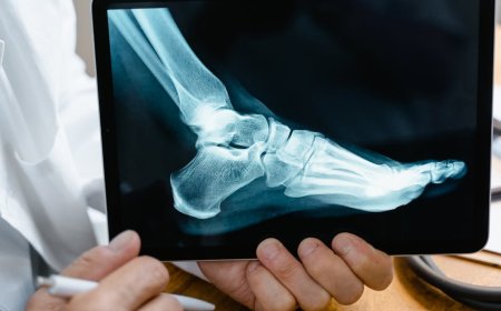 Mitos Kesehatan Mulut dan Usus Pengaruhi Jantung Serta Tidur Malammu