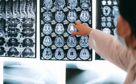 Puasa Intermiten Baik untuk Otak? Manfaat Kognitif dan Neuroproteksi Terungkap