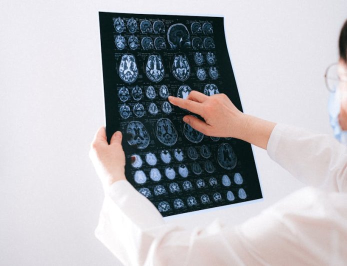 Mitos Alzheimer Terbongkar: Fakta Ilmiah dan Harapan di Balik Riset Medis