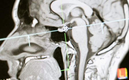 Fakta Profil Tidur yang Sering Keliru dan Dampaknya untuk Kesehatan