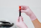 Golongan Darah B dan Diabetes Tipe 2 Apa Kata Riset