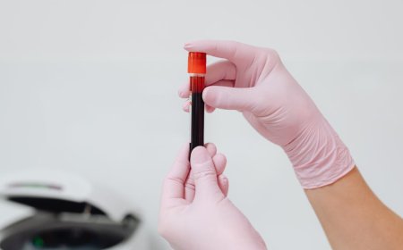 Golongan Darah B dan Diabetes Tipe 2 Apa Kata Riset