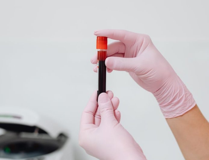 Golongan Darah B dan Diabetes Tipe 2 Apa Kata Riset