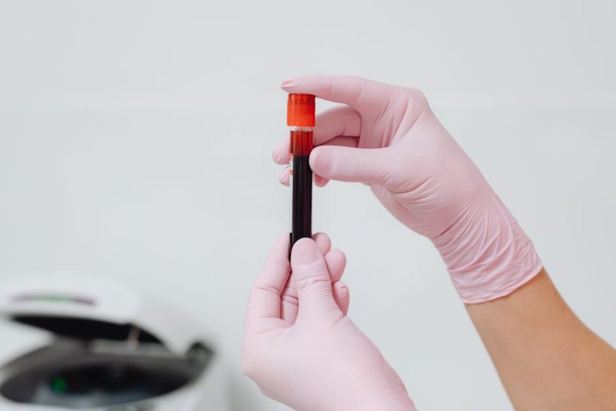 Golongan Darah B dan Diabetes Tipe 2 Apa Kata Riset