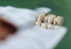 Risiko Reformasi Capital Gains Tax Australia bagi Startup