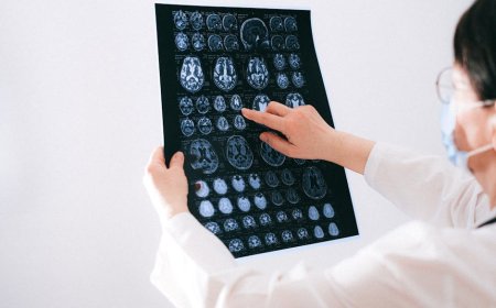 AI di Rumah Sakit Persahabatan Viet Tiep Diagnosis Neuromuskular