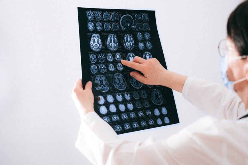 AI di Rumah Sakit Persahabatan Viet Tiep Diagnosis Neuromuskular